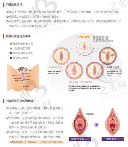 术后一周:修复期的关键阶段