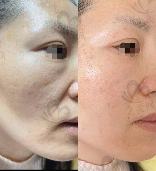 韩国Shinebeam皮肤科怎么样——热门项目