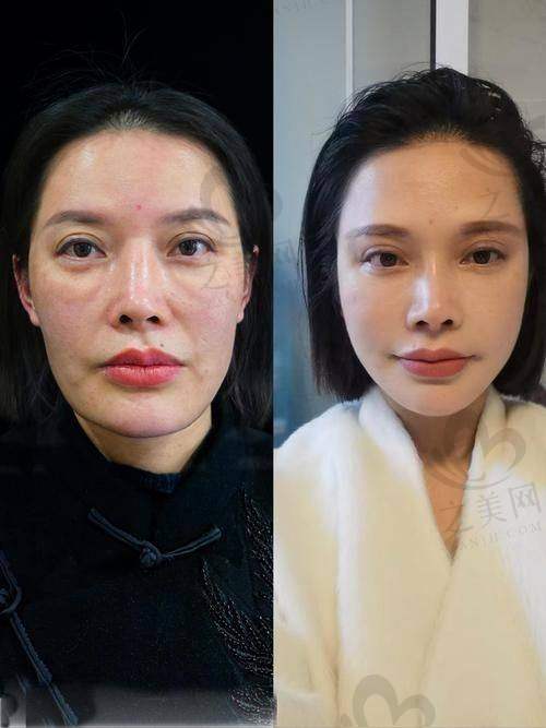 韩国EverM爱宝整形医院怎么样？正规资质+涵盖面部轮廓、双鄂整形等项目