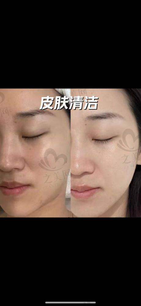 韩国blessing祝福皮肤科地址在哪——价格与服务优势