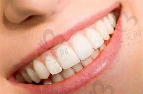 佛山拜博口腔非常新价格公开,种植牙/牙齿矫正/烤瓷牙价格都在这~