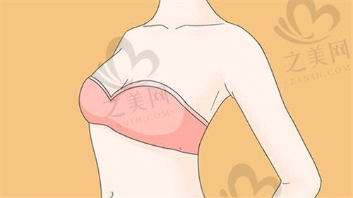 烟台曙光医疗美容医院聂瑞锋假体隆胸17640元起，价格实惠性价比高