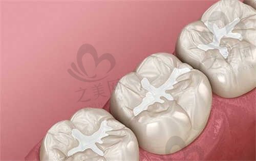 西安市未央区哪家口腔医院补牙好?西安中诺口腔补牙380元起,地铁直达