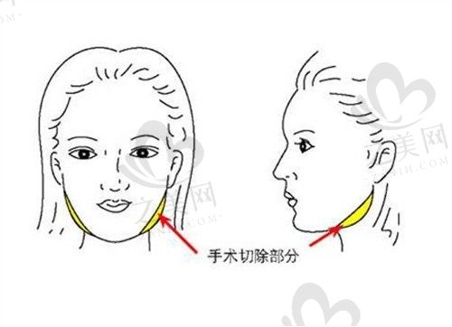 北京联合丽格和八大处哪家做磨骨手术更靠谱?对比一下就知道了