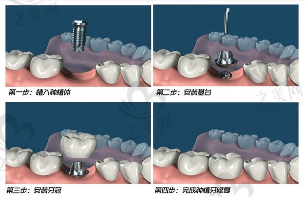 西宁润和口腔诊所怎么样?口碑评价都在线,且价格不贵