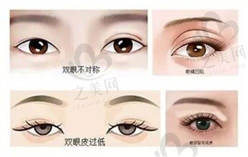 种植牙价格怎么样_之美网