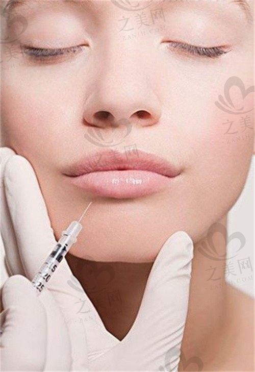 武汉一美医疗美容门诊部徐宇红去法令纹6625元起，做过的都说好