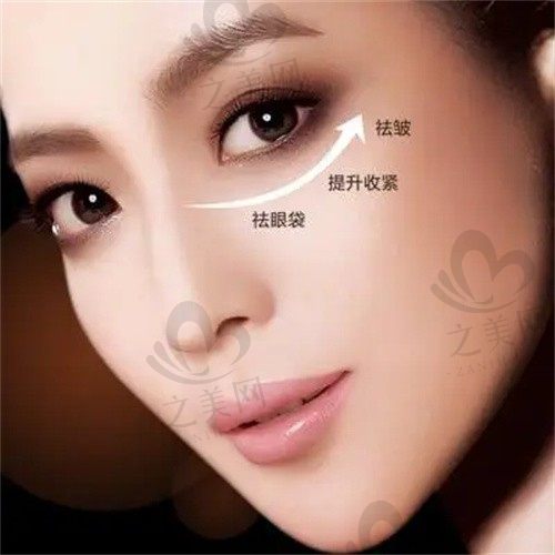 东莞缔美美容医院游定良祛眼袋价格3680元起，告别疲惫“金鱼眼”！