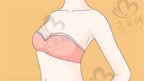 丽水心艺医疗美容赵俊医生隆胸3w元~16w元,隆胸效果真的很不赖