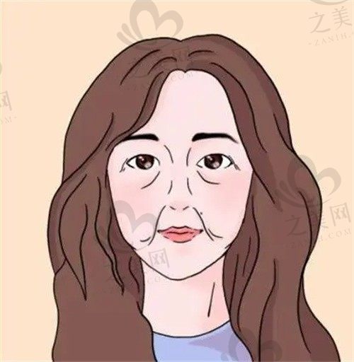 梅州曙光整形医院李瑞脸部不对称手术8000元起，改善脸部不平脸部凹陷