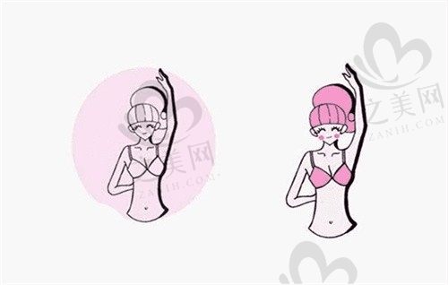 深圳宝丽郑梦雄做自体脂肪丰胸价格39800元起，效果自然更安全！