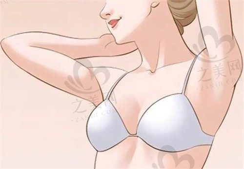 南京华美美容医院沈正宇自体脂肪隆胸2w元起，打造圆润性感的胸型