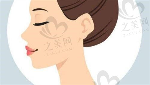 四川绵阳韩美整形彭太平胶原蛋白隆鼻17000元起，鼻子精致挺立起来了