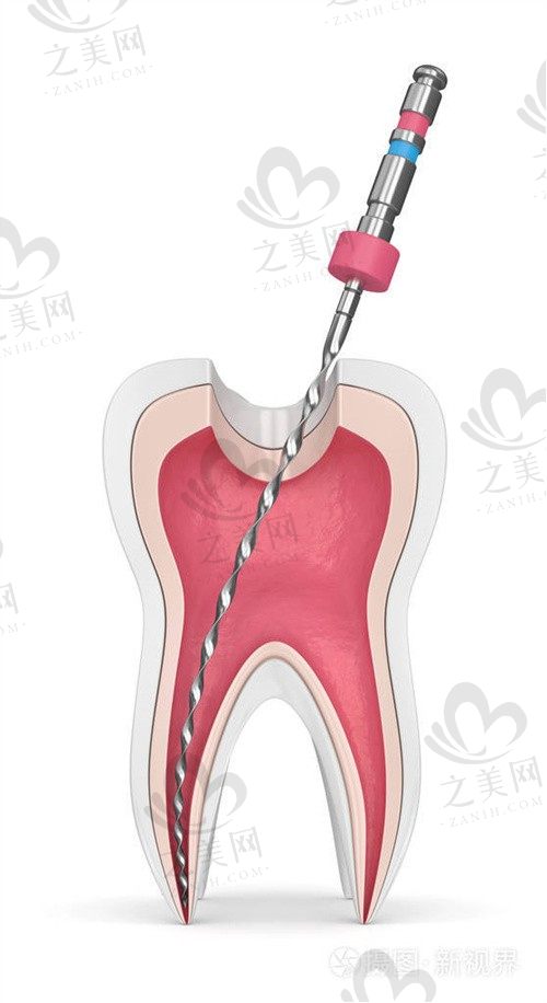 吉林市张杰口腔门诊部怎么样?根管治疗技术很好,来看患者真实评价