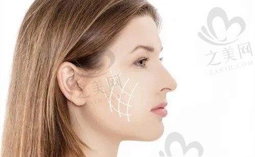 北京京城皮肤医院杨晶做全脸热玛吉价格6192元起，解决松弛下垂效果好