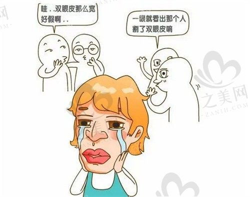 北京丰联丽格师丽丽做双眼皮修复4000元起，打造气质美眼