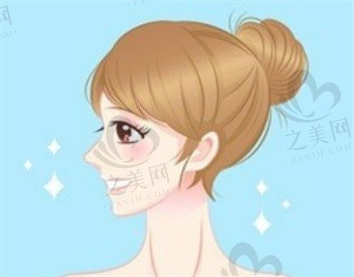 绍兴脸博士医疗美容周建英医生硅胶隆鼻41839元起，鼻子精致挺立起来了