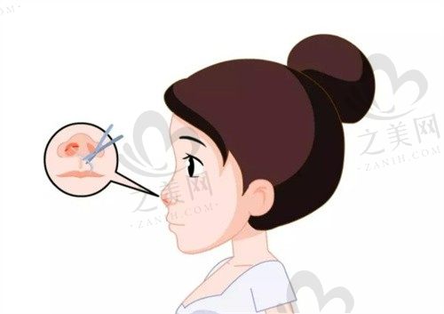 绍兴脸博士医疗美容医院怎么样?医院隆鼻效果好,给出隆鼻价格表