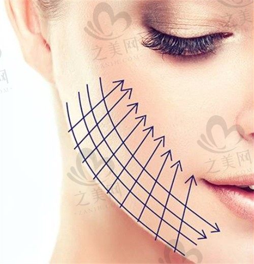 深圳八大处整形祁峰面部提升8000元起，解决面部松弛下垮