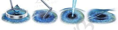 种植牙价格怎么样_之美网