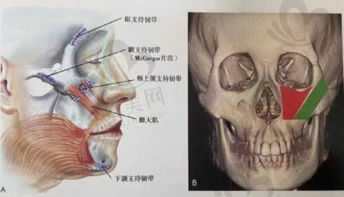 李志海颧骨手术技术