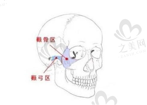 上海李志海磨骨技术真不错！颧骨内推,下颌角风格自然,价格8万起