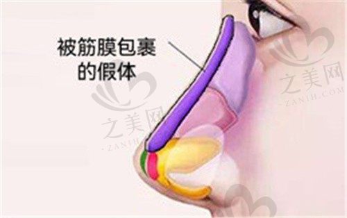 深圳鹏程整形医院刘冰做鼻子怎么样？耳软骨鼻综合技术佳价格11960
