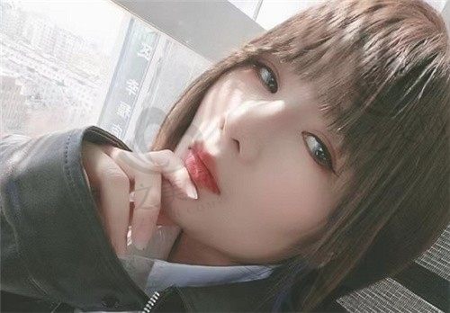 杭州李波医生做肋软骨隆鼻真赞,分享我做鼻子术后半年的亲身感受