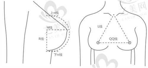 余成坤隆胸技术好吗？