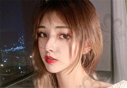 上海华美李健做鼻子厉害吗?聊聊我做隆鼻术后一年的真实感受