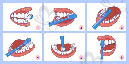 护齿小技巧1
