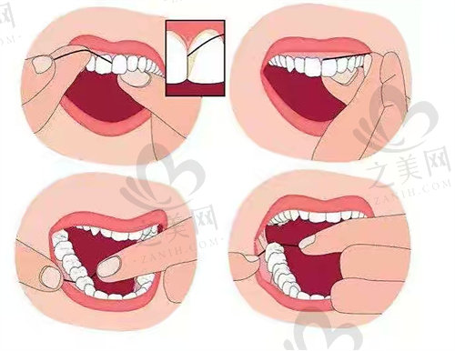 滚轴式牙线使用方法2