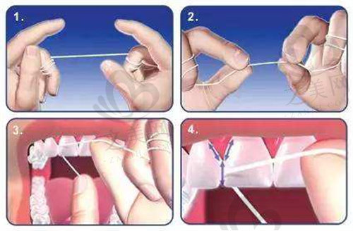 牙线的作用