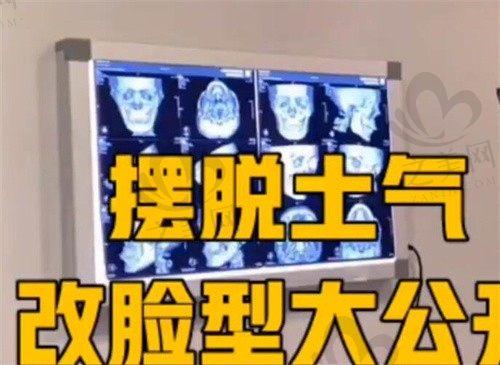 赵贵庆做磨骨经验深厚资质齐全,颧骨内推整形71520元起！