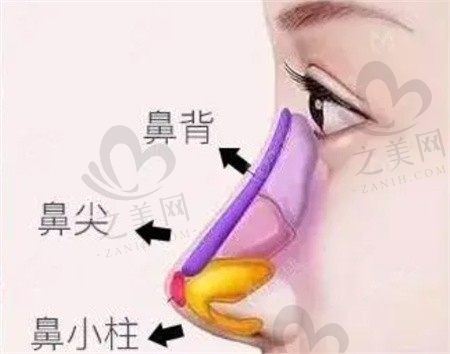 武汉五洲整形胡乔做鼻整形怎么样？肋骨鼻综合3W起技术真的好