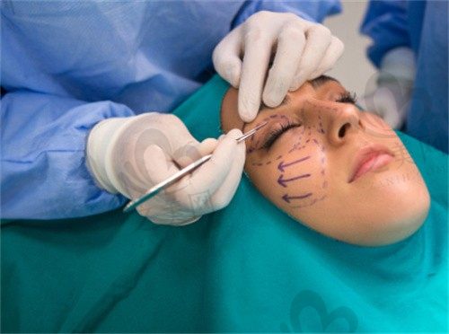 北京杨大平做拉皮手术怎么样？杨大平小切口MACS提升手术只要35000