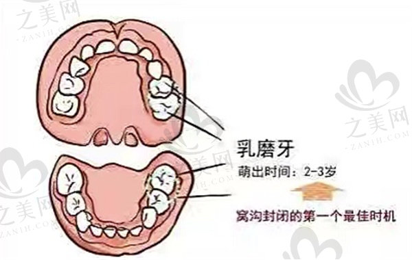 乳磨牙