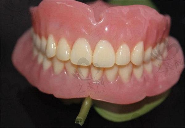半口半固定种植牙是什么意思？