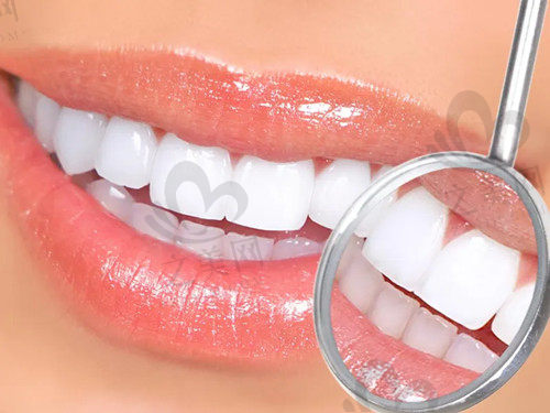 牙齿美白修复方式