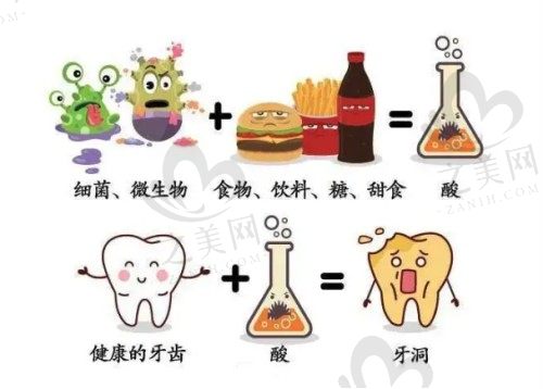 不好的饮食习惯致龋