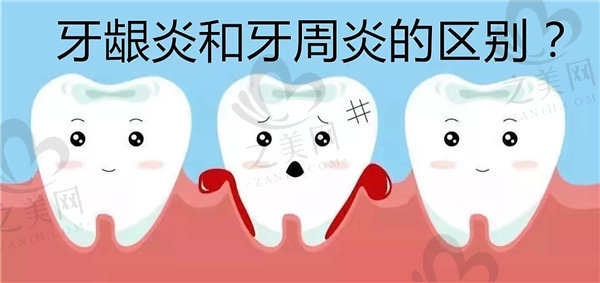 牙龈炎和牙周炎的区别与预防牙齿问题的方法