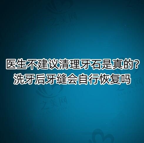医生不建议清理牙石是不是真的?洗牙后牙缝会自行恢复吗