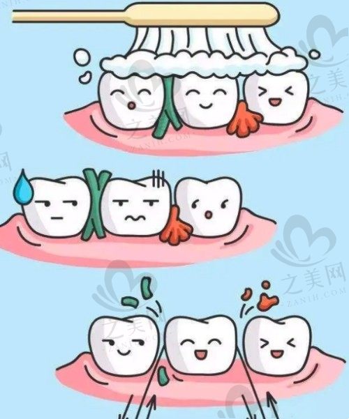 牙齿清洁
