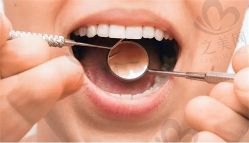 牙周病等口腔疾病是导致口臭的主要原因