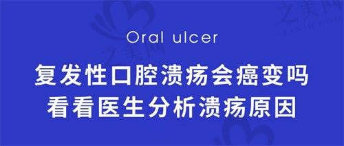 复发性口腔溃疡会癌变吗?半个月还没好怎么办 听听医生怎么说
