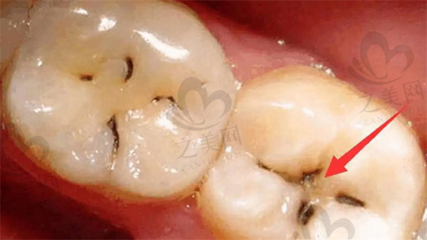 牙科病症图片