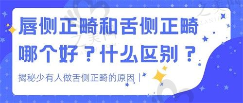 舌侧正畸和唇侧正畸哪个好?为什么很少人舌侧正畸?