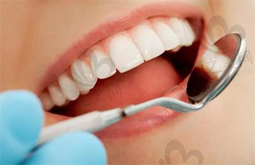 牙齿贴面是一种较快的修复方式
