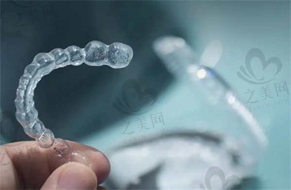正雅隐形牙套需要戴多久才能摘下来呢?成效能维持几年?