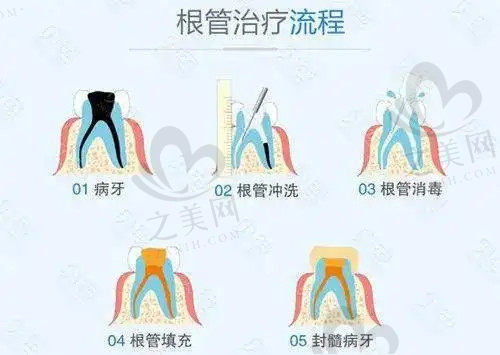 治疗目的和价格